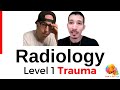 Radiology tech life in a level 1 trauma center yourxraytechpodcast
