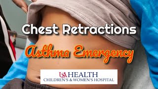 Chest Retractions in a Severe Asthma Attack