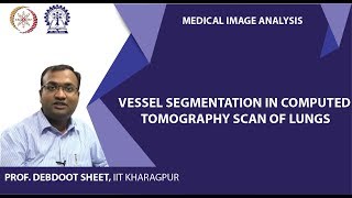Vessel Segmentation in Computed Tomography Scan of Lungs