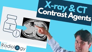 Contrast Agents in X-ray and CT Scans: What You Need to Know screenshot 1