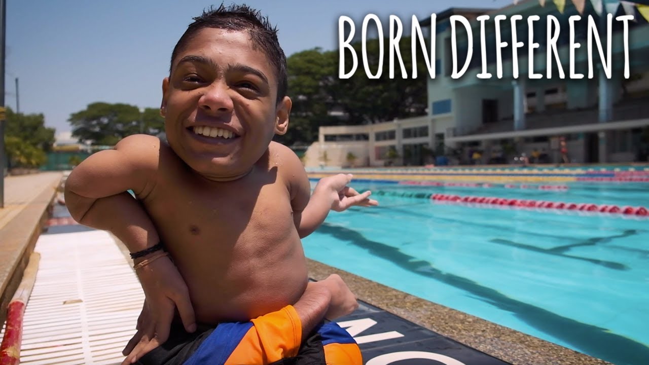 The Swimmer With Bones Like Glass | BORN DIFFERENT