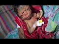 Doctors couldn&#39;t stop screaming when they saw the new born&#39;s face - short stories | viral story