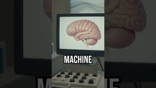 Sleep fuels intelligence #neuroscience #braintech #sleep