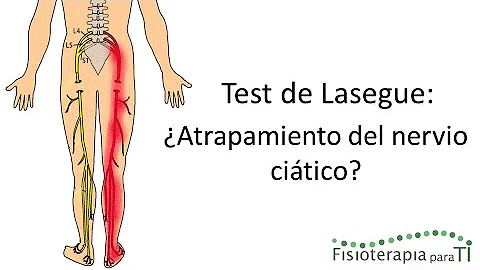 ¿Qué hará un fisioterapeuta para la ciática?