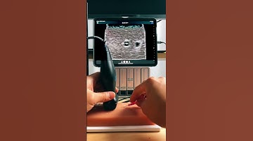 demo - transverse view.mp4