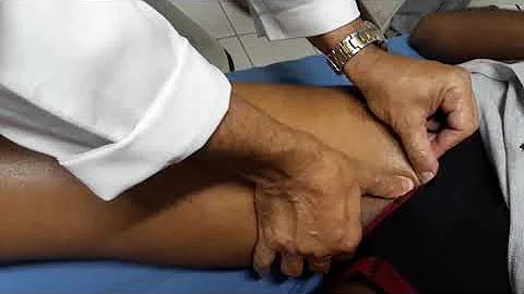 O que é distensão muscular na coxa?