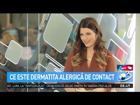 Video: Alergie La Bere: Simptome, Cauze și Tratament