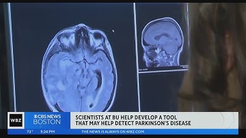 Artificial intelligence could help detect Parkinson