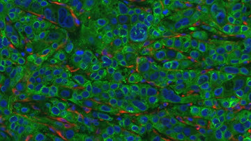 Advances in Modeling Cancer in Mice: Technology, Biology, and Beyond