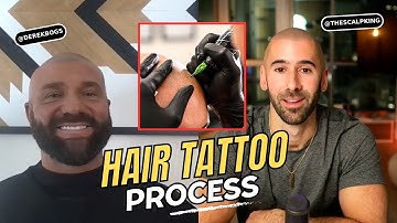 Why scalp micropigmentation isn