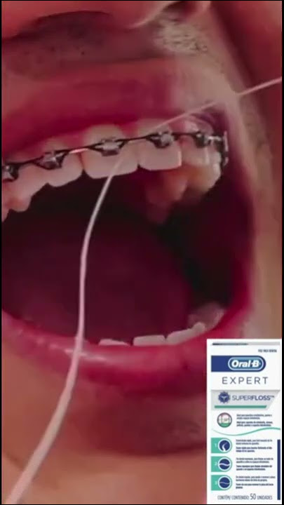 Hilo Dental Superfloss Oral B