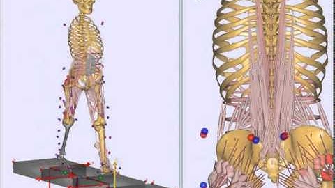 Muscle-driven simulation of transtibial amputee walking
