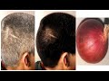 White Hair Turn To Black Hair Naturally in 4 minutes | Gray hair dye with onion | ผมหงอกก่อนวัย แก้