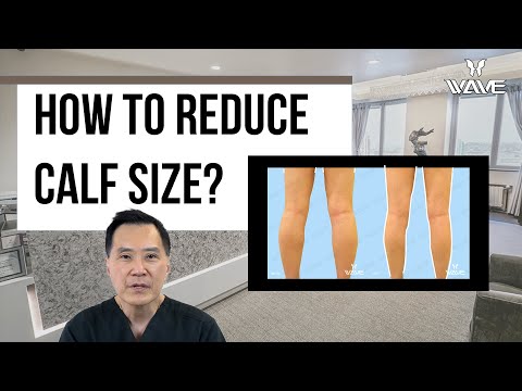 Video: How To Reduce Calf Size