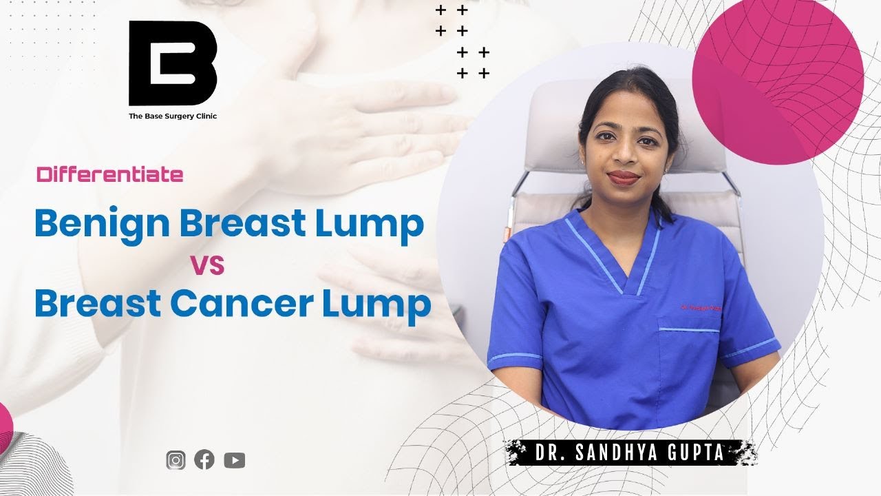 Cancer Vs Non cancerous lumps of breast | Are all lumps Dangerous? - Dr ...