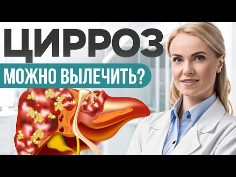 Цирроз печени: чем лечить? Причины? Сколько живут ► Как распознать цирроз печени на ранних стадиях?