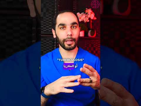 أكثر سبب لمرض الصرع