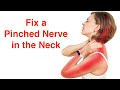 Fix a Pinched Nerve in the Neck (With FREE Exercise Sheet!)