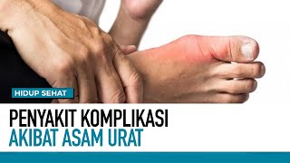 Penyakit Komplikasi Akibat Asam Urat | Hidup Sehat tvOne