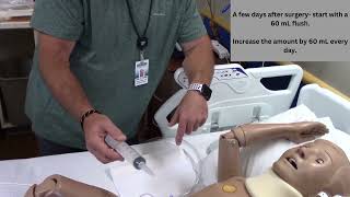 Post Surgical Care of the ACE, Antegrade Continence Enema.