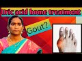 Uric acid home treatment 💯✅ | கடையில் சாப்பிட்டால் URIC ACID அளவு அதிகமாகுமா? ✅✴️