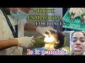 Tooth extraction for braces vlog  how to brush and eat after extraction  is it painful 