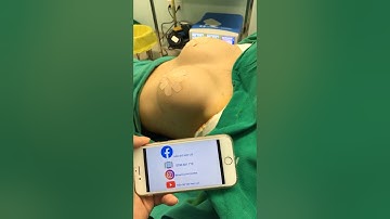 Nâng Ngực Đường Nách ? Có Sanh Em Bé Được Không? Thẫm Mỹ Viện Nam Lee 0796931719