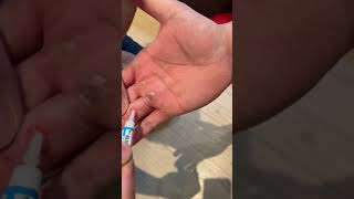 【トレ中に手の皮がめくれたら】瞬間接着剤で対処&トレ継続！　メンタルトレーニング　　400㎏素手ファーマーズウォーク　farmerswalk　ストロングマントレーニング　運搬能力　握力　#Shorts