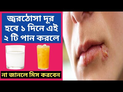 জ্বর ঠোসা দূর হবে ১ দিনে কোনো ওষুধ ছাড়াই চ্যালেঞ্জ | জ্বরঠোসা কারণ ও প্রতিকার | Bengali health tips