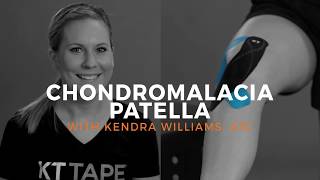 Chondromalacia Patella (Hội chứng Patellofemoral)