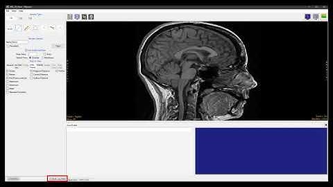 Analyze 14.0 - Measure: Line Profile Generation using Sample Lines