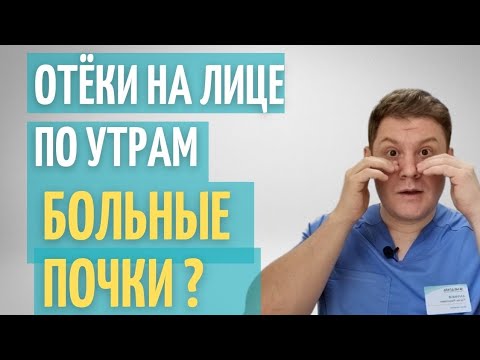 Лицо отекает по утрам // Самодиагностика дома