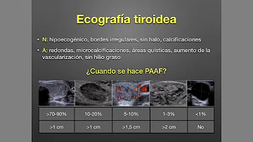 ¿Se puede saber si un nódulo tiroideo es canceroso con una ecografía?