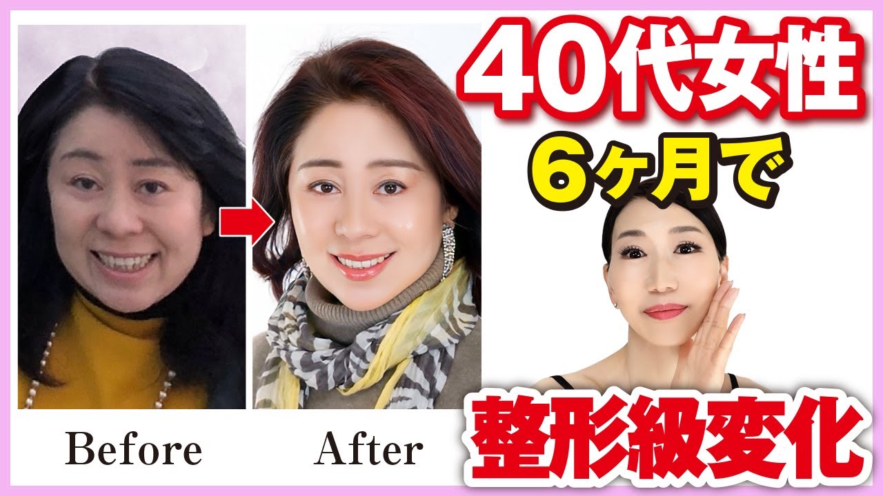 【マリオネットライン】40代女性が6ヶ月でここまで変わった方法！年齢が出る