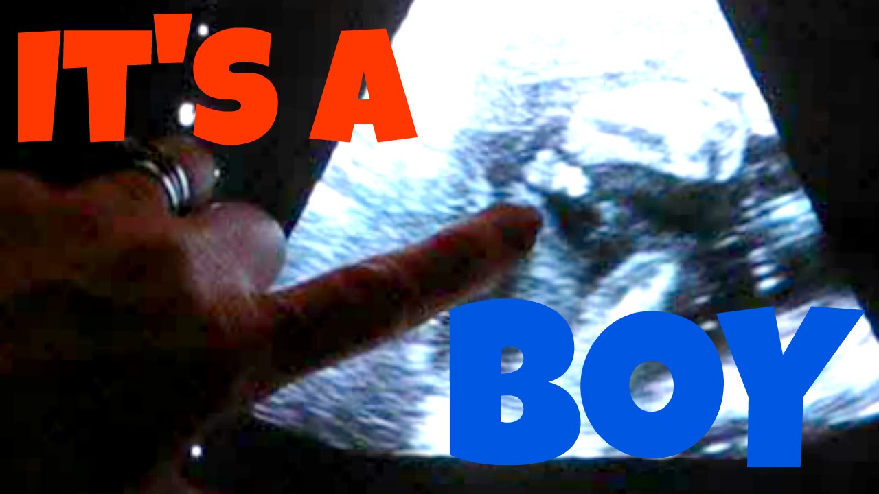Ultrasound At 21 Weeks It S A Boy Youtube