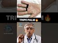 Tripe palm| Best app for NEET PG Preparation |Dopamine|