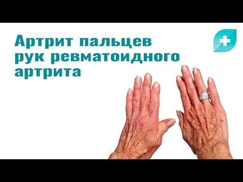 Артрит пальцев рук ревматоидного артрита: причины, симптомы и лечение