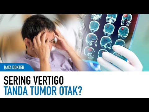 Vertigo Buat Pandangan Berputar-putar, Begini Fakta dan Mitosnya | Kata Dokter