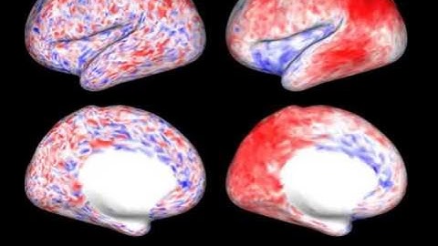 Visualization of brain activity, with and without tNLM filtering - Left hemisphere