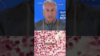 Doctor explains hantavirus after Gene Hackman and wife's death