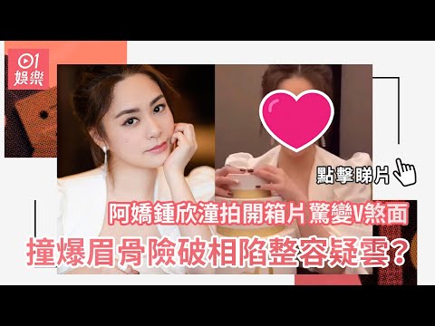 阿嬌鍾欣潼拍開箱片驚變V煞面　撞爆眉骨險破相陷整容疑雲？