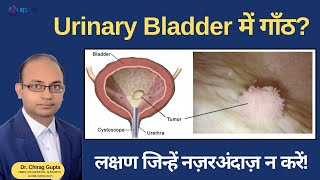 Is a Urinary Bladder Lumps Dangerous or Not? | Bladder Lumps: Who is at Risk | Complete Information screenshot 3