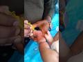 #How to Insert Cannula in Arm | Nursing Students Must Watch #nurse #doctor #shorts #child_hospital#.