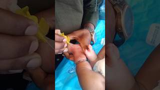 #How to Insert Cannula in Arm | Nursing Students Must Watch #nurse #doctor #shorts #child_hospital#.
