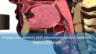 Normal Swallow Video - Patient Education | MedBridge screenshot 1