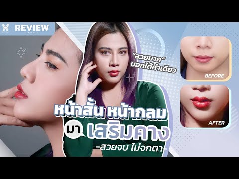 หน้าสั้น หน้ากลม มาเสริมคาง สวยจบ ไม่จกตา I Review Bepround EP.29