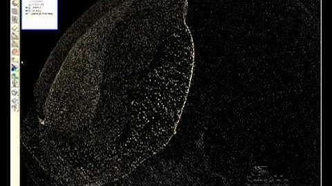 13  Skull Implant Modelling using SensAble FreeForm Modelling Plus