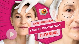 Non-Surgical Facelift with Lifting PDO Threads! | Istanbul 🇹🇷