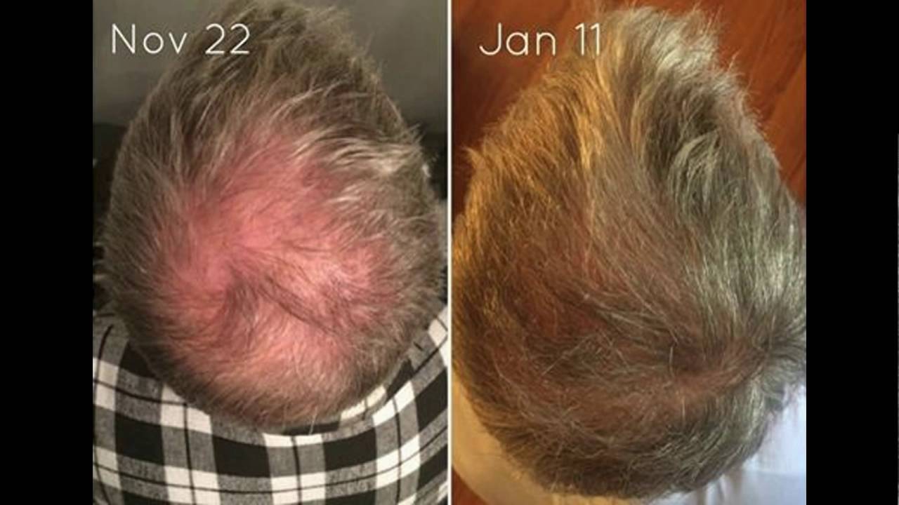 Monat For Men Youtube