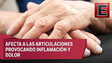 ¿Cuál es la fase final de la artritis reumatoide?